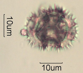 Dandelion (Taraxacum officinale) Pollen