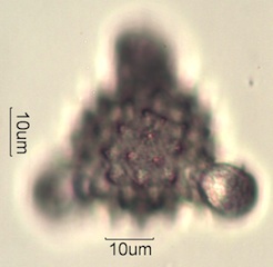 Cirsium sp. Pollen