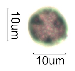 Pollen from Swedish Honey Under the Microscope