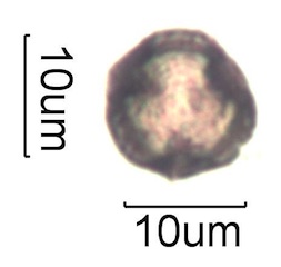 Pollen from Swedish Honey Under the Microscope