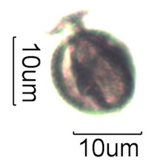 Pollen from Swedish Honey Under the Microscope