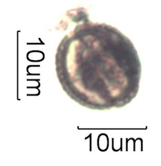 Pollen from Swedish Honey Under the Microscope