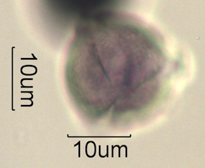 Pollen from Swedish Honey Under the Microscope