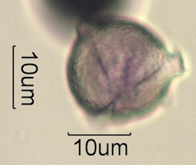 Pollen from Swedish Honey Under the Microscope