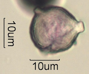 Pollen from Swedish Honey Under the Microscope