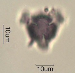 Pollen from Swedish Honey Under the Microscope