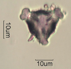 Pollen from Swedish Honey Under the Microscope