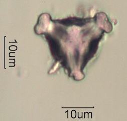 Pollen from Swedish Honey Under the Microscope