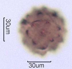Washington State Honey Pollen Under the Microscope