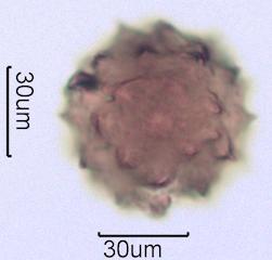 Washington State Honey Pollen Under the Microscope