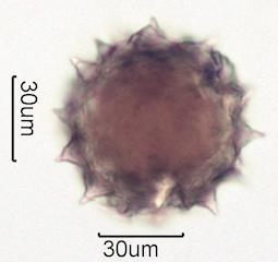Washington State Honey Pollen Under the Microscope