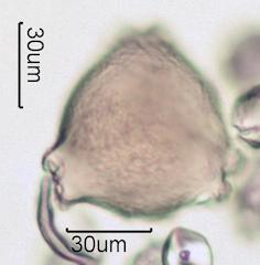 Washington State Honey Pollen Under the Microscope