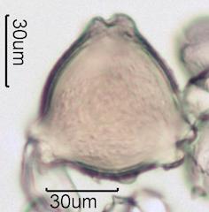 Washington State Honey Pollen Under the Microscope