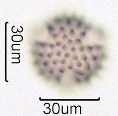Washington State Honey Pollen Under the Microscope