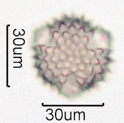 Washington State Honey Pollen Under the Microscope