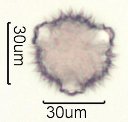 Washington State Honey Pollen Under the Microscope