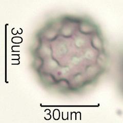 Washington State Honey Pollen Under the Microscope