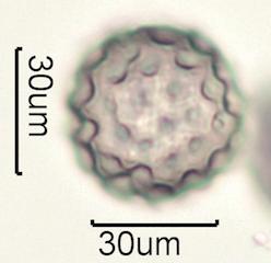 Washington State Honey Pollen Under the Microscope