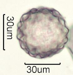 Washington State Honey Pollen Under the Microscope