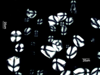 Sago Starch Under the Microscope
