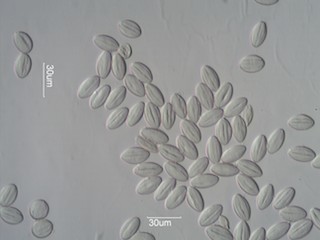 Elderberry (Sambucus) Pollen under the Microscope