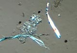 Food Debris