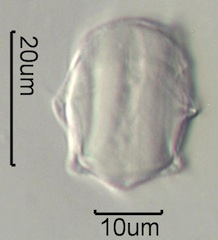 Scotch Broom (Cytisus scoparius) Pollen