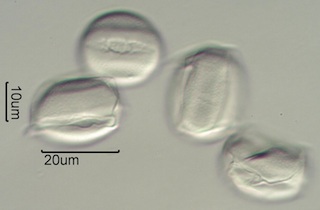 Scotch Broom (Cytisus scoparius) Pollen