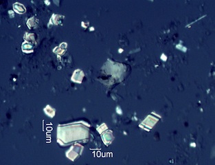 Calcium Oxalate Phytoliths from the Leaves of Amelanchier alnifolia