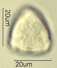 Serviceberry (Amelanchier spp.) Pollen under the Microscope
