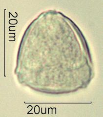 Serviceberry (Amelanchier spp.) Pollen under the Microscope