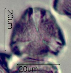 Serviceberry (Amelanchier spp.) Pollen under the Microscope