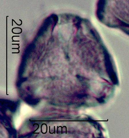 Serviceberry (Amelanchier spp.) Pollen under the Microscope