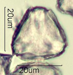 Serviceberry (Amelanchier spp.) Pollen under the Microscope