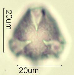 Serviceberry (Amelanchier spp.) Pollen under the Microscope