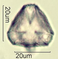 Serviceberry (Amelanchier spp.) Pollen under the Microscope