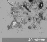 Silicoflagellate, Distephanus speculum