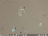 Human Skin Flakes