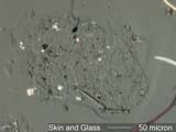 Human Skin Flakes