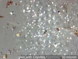 Human Skin Flakes