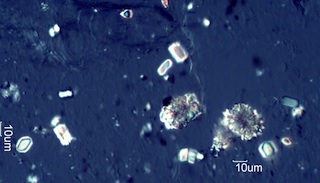 Calcium Oxalate from Snowberry (Symphoricarpus albus) Leaves