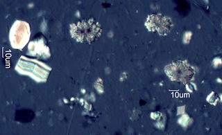 Calcium Oxalate from Snowberry (Symphoricarpus albus) Leaves