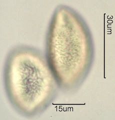 Solomon’s Plume (Smilacina stellata also Maianthemum stellatum) Pollen