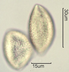 Solomon’s Plume (Smilacina stellata also Maianthemum stellatum) Pollen