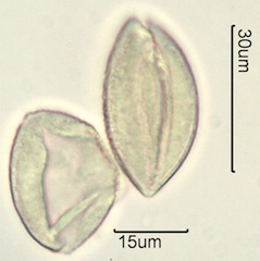 Solomon’s Plume (Smilacina stellata also Maianthemum stellatum) Pollen