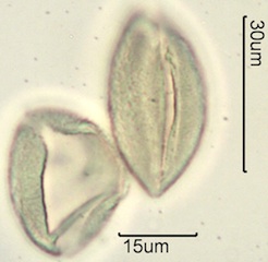 Solomon’s Plume (Smilacina stellata also Maianthemum stellatum) Pollen