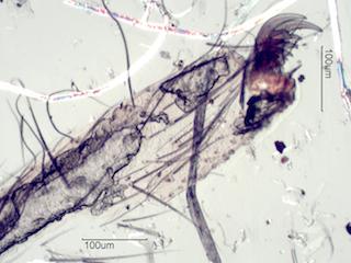 foot of Spider