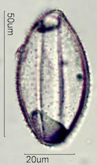 Spider Lillie Pollen