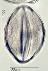 Spider Lillie Pollen