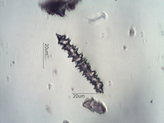 Sponge Spicule Under the Microscope